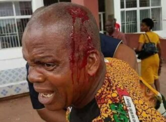 Fact-Check: Image of Man with Head Injury Linked to Anambra Election is Misleading.