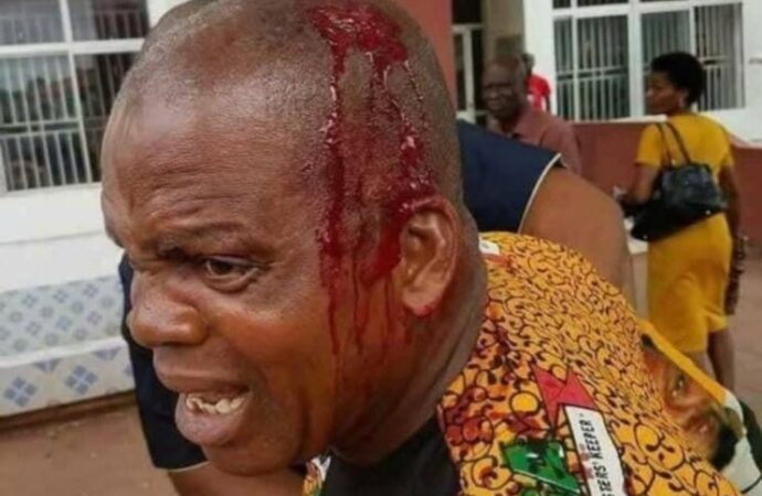 Fact-Check: Image of Man with Head Injury Linked to Anambra Election is Misleading.